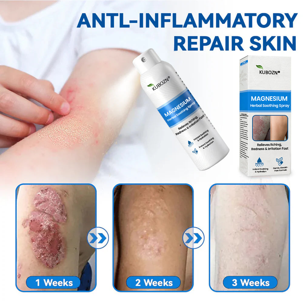 ✅ Official Store: Kubozn® Magnesium Herbal Skin Relief Spray Helps calm irritated, itchy & problem-prone skin