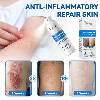 ✅ Official Store: Kubozn® Magnesium Herbal Skin Relief Spray Helps calm irritated, itchy & problem-prone skin