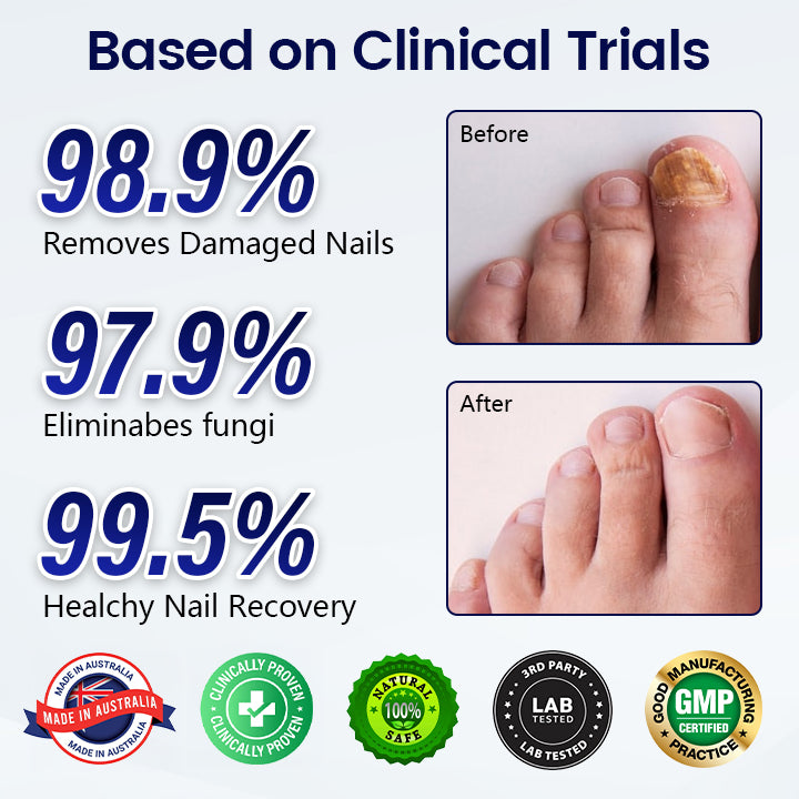 Healrize® Anti-Fungal Nail Repair Patch