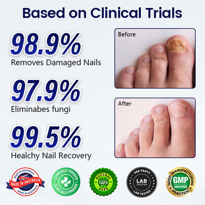 Healrize® Anti-Fungal Nail Repair Patch