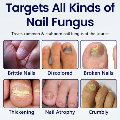 Healrize® Anti-Fungal Nail Repair Patch